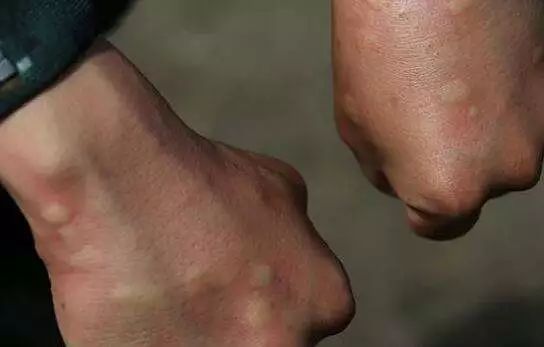 驱蚊神器灭蚊灯静音无辐射,灭蚊灯是根据什么原理灭蚊的