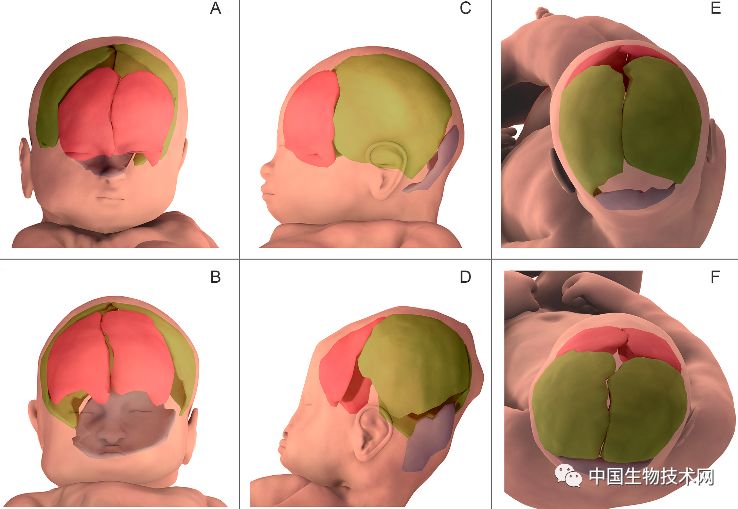胎儿3d表面成像,3d影像婴儿诞生全过程