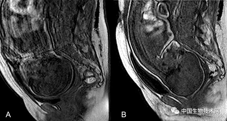 胎儿3d表面成像,3d影像婴儿诞生全过程