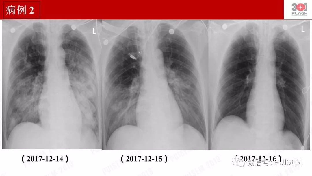 精彩幻灯｜朱海燕：血液净化的抗凝治疗