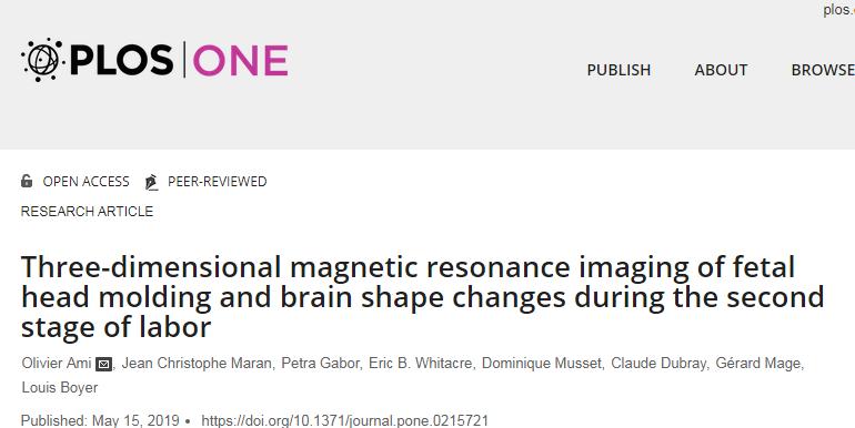 PLOSOne：为什么婴儿刚生下来头容易变形？科学家3D图像揭秘其中“奥妙”