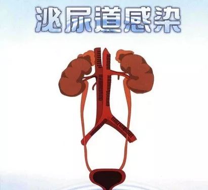 老年人股骨颈骨折康复教程,70岁股骨颈骨折保守治疗成功案例