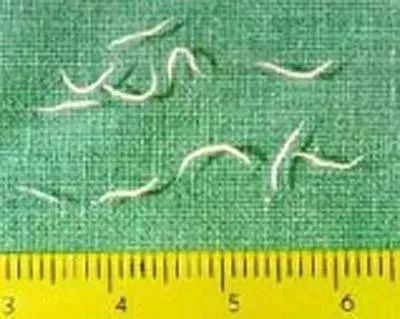 惊！长春高二女生头上洗出数条1厘米长白虫子！这个习惯你有吗？