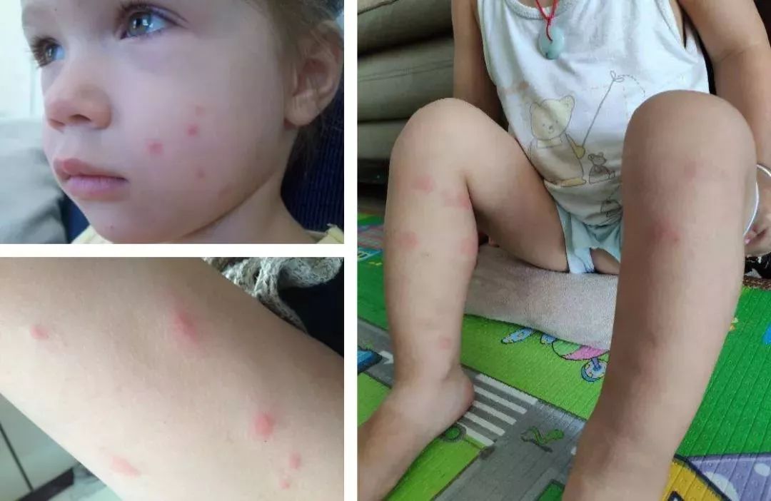 防蚊卷帘通风吗,怎么解决防蚊帘风一吹就开