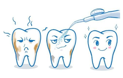 关注口腔问题,当心牙缝