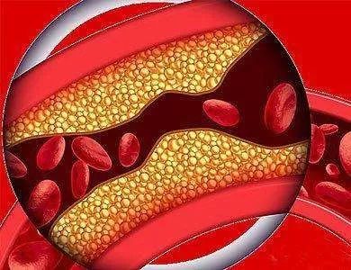 王清任的36个方剂分别治疗什么病,王清海中医治疗扩心病