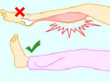 孕妇怀孕后期小腹疼痛抽筋,怀孕初期肚子抽筋的疼一直出血