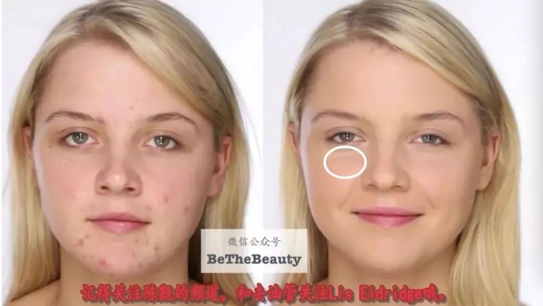 灰头土脸怎么改善,灰头土脸怎么预防