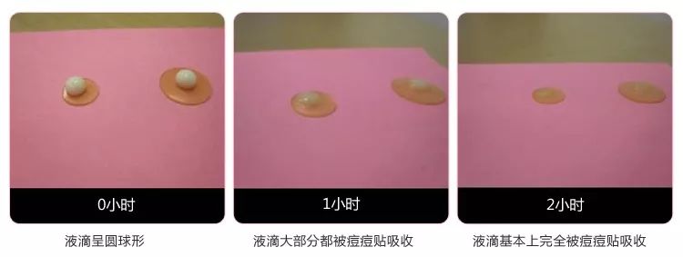 灰头土脸怎么改善,灰头土脸怎么预防