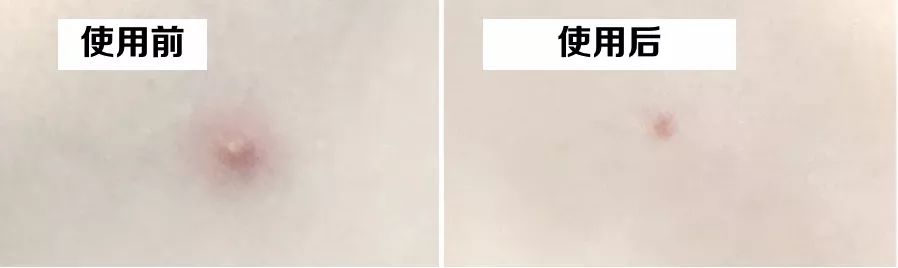 灰头土脸怎么改善,灰头土脸怎么预防