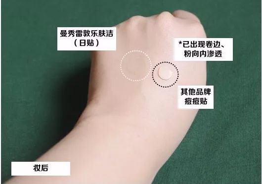 灰头土脸怎么改善,灰头土脸怎么预防