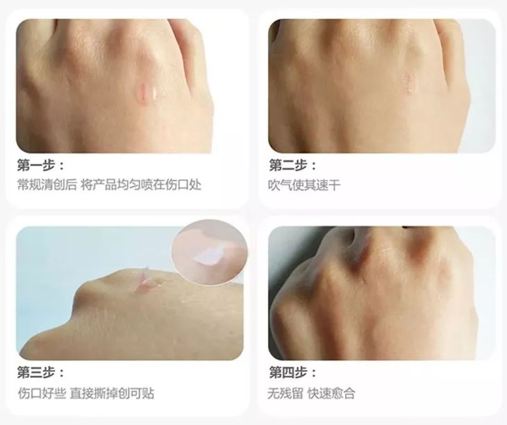 喷雾式防水创可贴,液体创可贴有效果吗