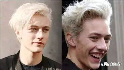 一笑就露出牙花怎么办,口呼吸导致的露龈笑如何治疗