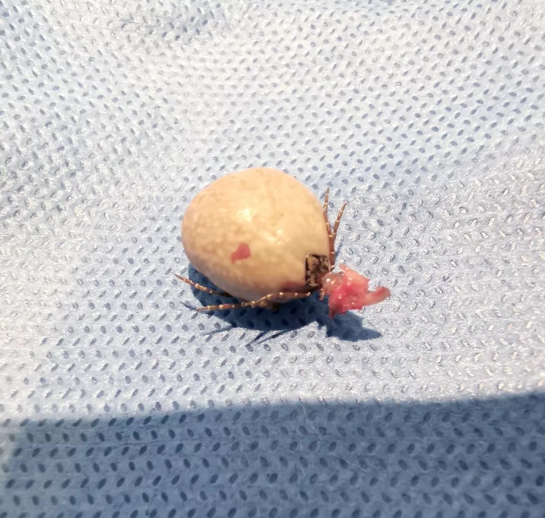 成人肚脐眼凸起肉球,肚脐眼隆起的肉球