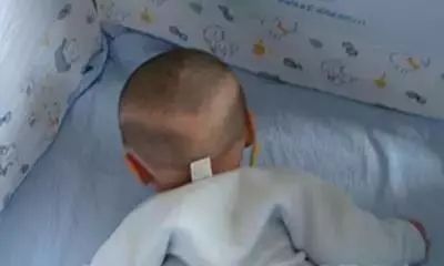 婴儿一直补钙还枕秃,9个月宝宝枕秃成圈状需要补钙吗