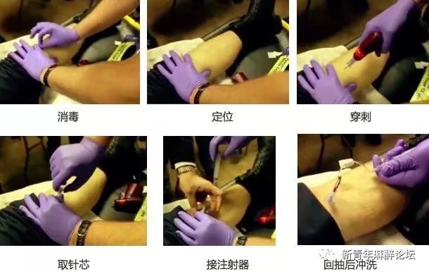 护士不知晓输血反应流程原因分析,护士不知晓输血反应的原因分析