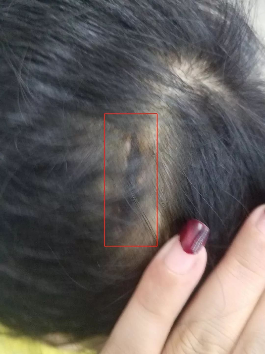 女童遭家暴送医后死亡,河源女婴被爸爸暴打