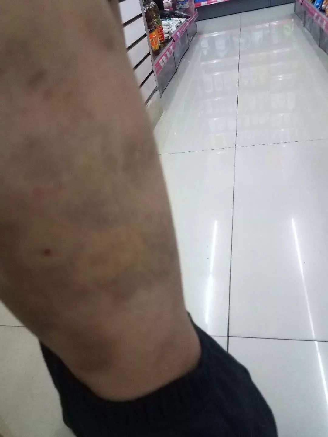 女童遭家暴送医后死亡,河源女婴被爸爸暴打