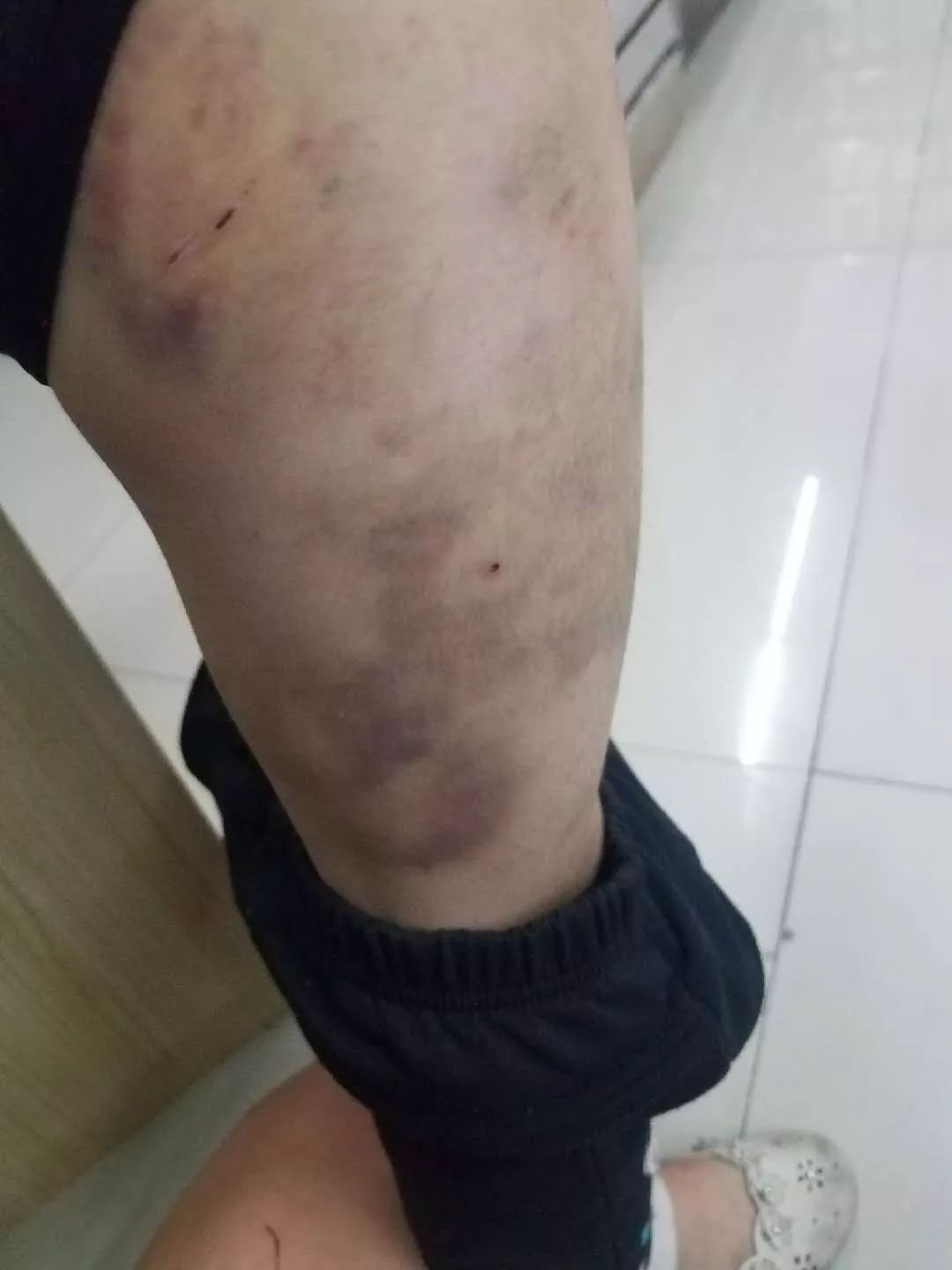 女童遭家暴送医后死亡,河源女婴被爸爸暴打