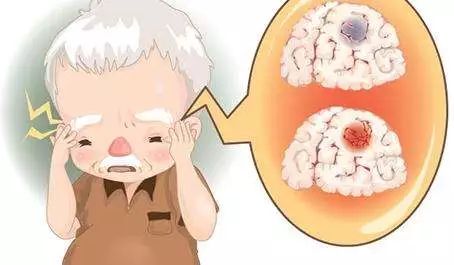 这类病春季多发专家早发现早治疗,今年激增的疾病