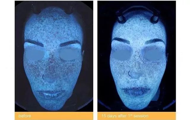 夏天被粉红色泡泡承包，嫁给爱情的女孩脸上都挂着糖霜