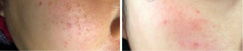 夏天被粉红色泡泡承包，嫁给爱情的女孩脸上都挂着糖霜