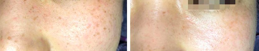 夏天被粉红色泡泡承包，嫁给爱情的女孩脸上都挂着糖霜