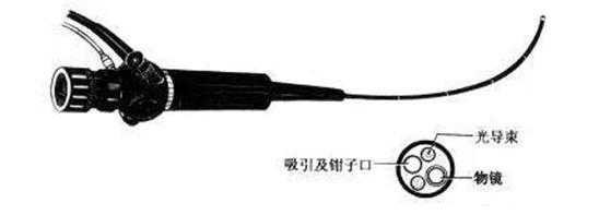 江苏鱼刺卡喉,慈溪鱼刺卡到喉咙1分钟轻松解决