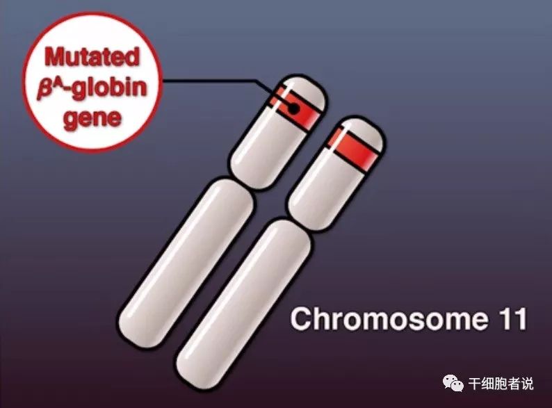 地中海贫血基因疗法是骨髓移植吗,地中海贫血基因疗法还是半相合的