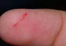 生命里的令人心疼的回忆,生命中最撕心裂肺的痛