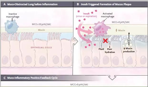 阻塞性肺疾病中医辨证论治,阻塞性疾病怎么治疗