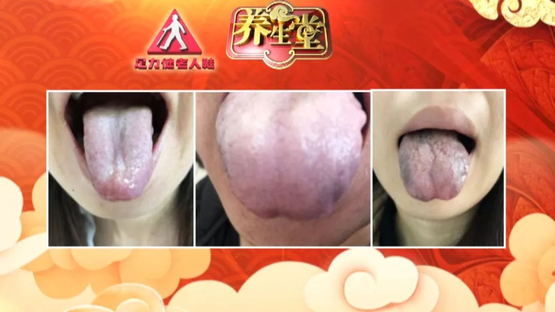 养生堂今日播出,养生堂今日播出的节目