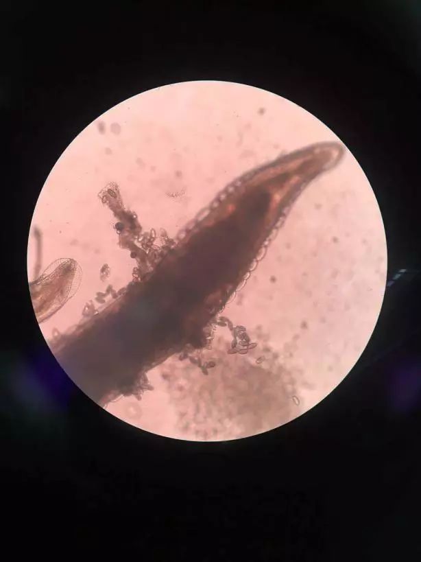 宝宝屁股痒怎样看到虫子,宝宝屁股痒发现虫子