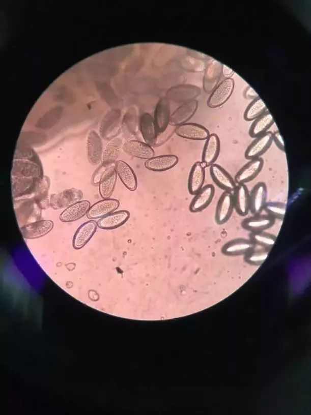 宝宝屁股痒怎么才能止痒,宝宝屁股痒痒怎么止痒