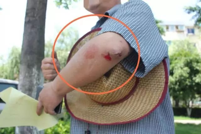 8厘米？女司机连撞3车伤1人！又是它惹的祸！