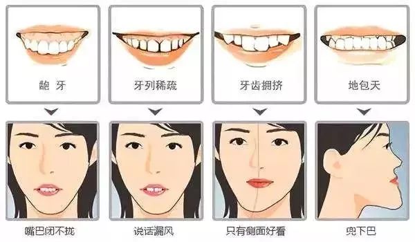 别人矫牙1万起，广州只要3960元！仅限2天
