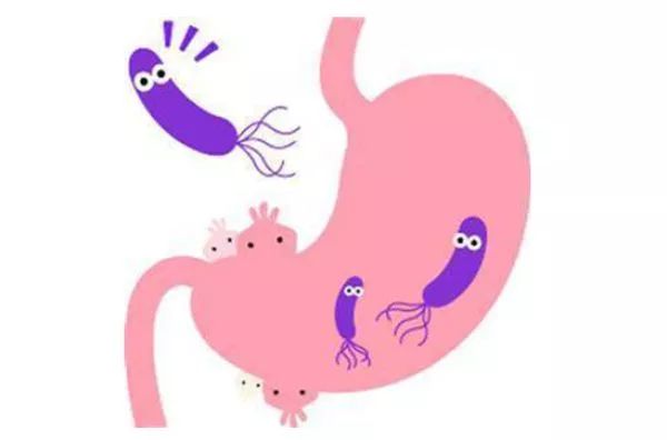 一个根除幽门螺旋杆菌的秘方,什么中成药治疗幽门螺旋杆菌有效