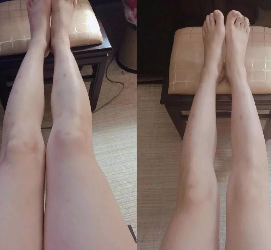 模特减肥一星期瘦二十斤,快速瘦肚子瘦腰懒人瘦身霜女