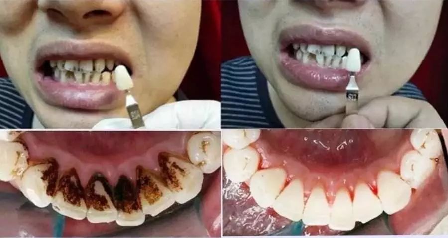 俄罗斯牙膏美白去口臭牙黄,去牙垢黄牙的牙膏测评