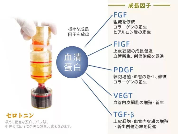 angelababy朝镜头走过来原视频ins,insangelababy