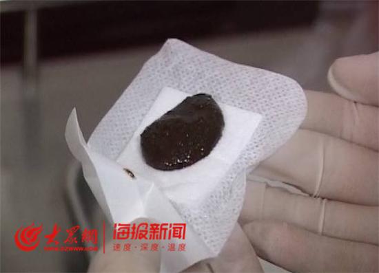 山东淄博治疗恶性肿瘤哪家医院好,淄博哪家医院治疗肿瘤最好