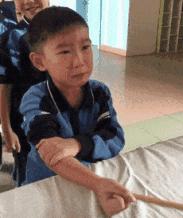 终于知道胳膊上的疤痕是怎么来的,终于知道为什么手臂上有疤了