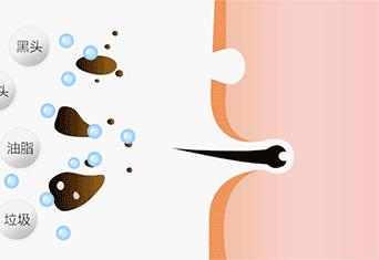 鼻头痘痘爆浆,鼻头痘痘挤出来的白色物质是什么