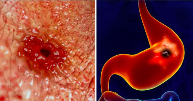 咖啡酱油都不碰，43岁“作”出钻石人生路