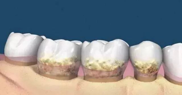 牙黄口臭的克星，有效洁白牙齿，并让口气清新！烟民必备的牙膏