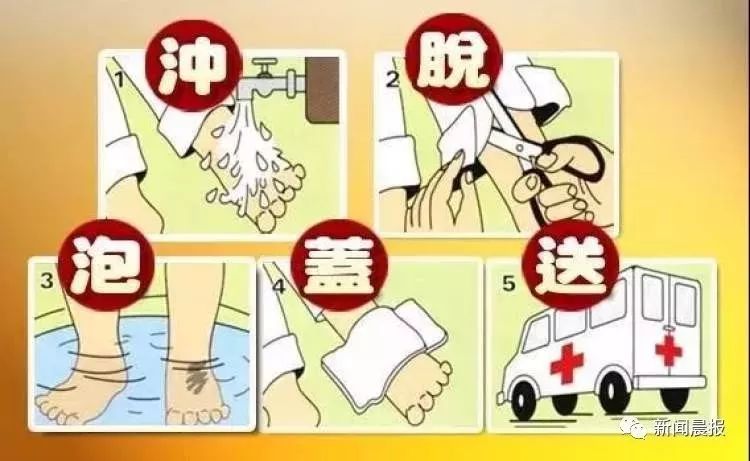 上海一岁半小孩烫伤,儿童烫伤家庭急救处理误区