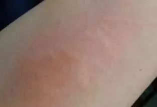 秋季使用花露水的禁忌,夏季花露水