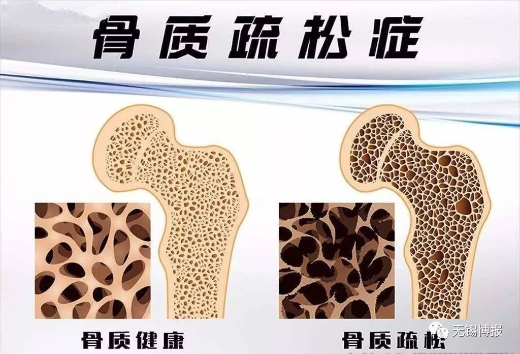 鼻子上长痘痘可以挤掉吗,鼻子长痘的快速消法