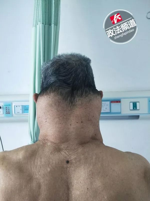 医院门诊来了两位“绿巨人”，他们都爱喝这个…