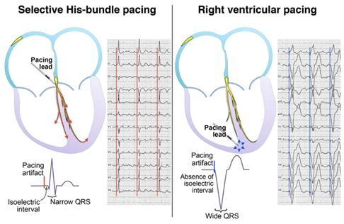 蹇冭剰灏勯娑堣瀺鏈悗澶嶅彂鐥囩姸,鐢茬姸鑵烘秷铻嶅悗10骞翠笉澶嶅彂